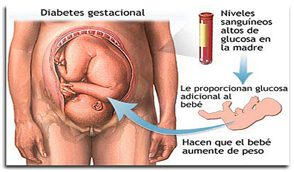 embarazo con diabetes