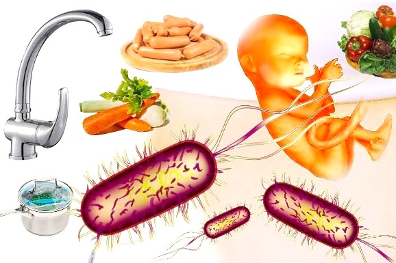 factores de riesgo listeriosis